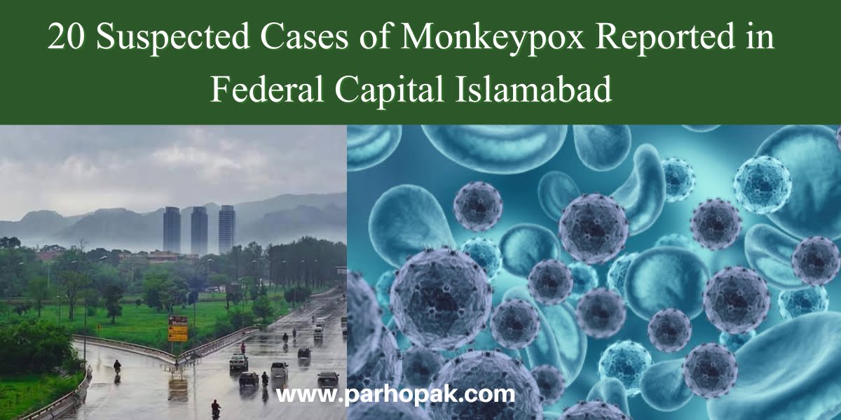 Monkeypox cases reported in Islamabad